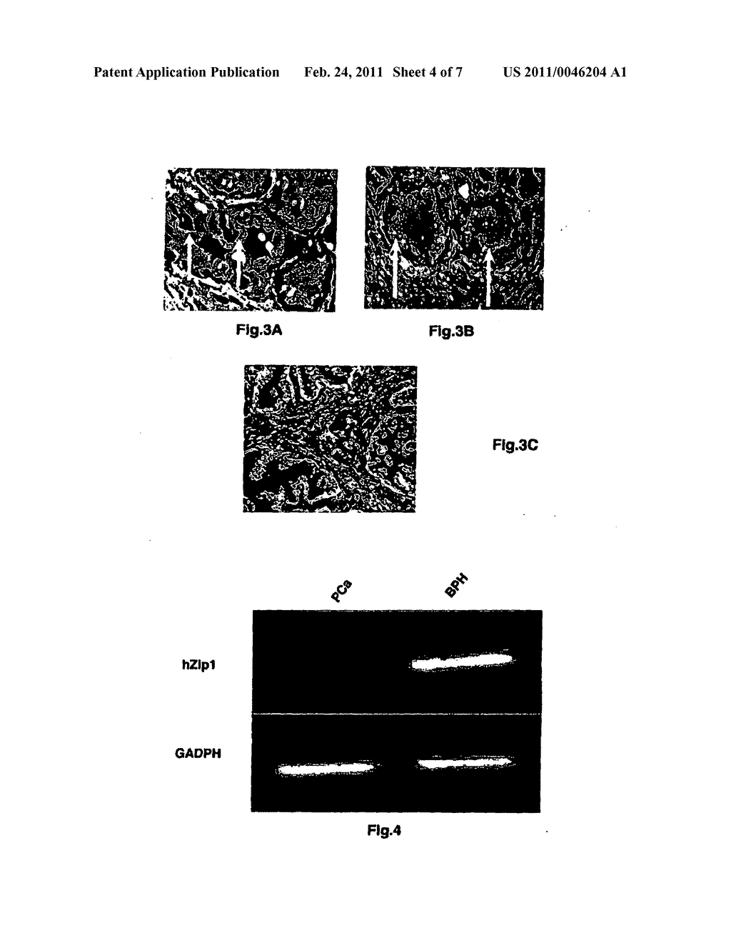 Human Zip1, Zinc and Citrate for Prostate Cancer Screening - diagram, schematic, and image 05