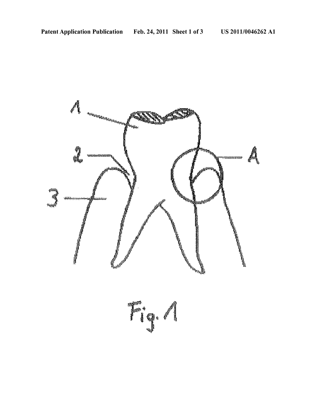 Pasty Insert Material for Widening of Gingival Sulcus and Use Thereof - diagram, schematic, and image 02