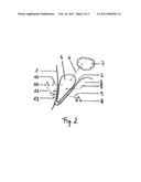 Pasty Insert Material for Widening of Gingival Sulcus and Use Thereof diagram and image