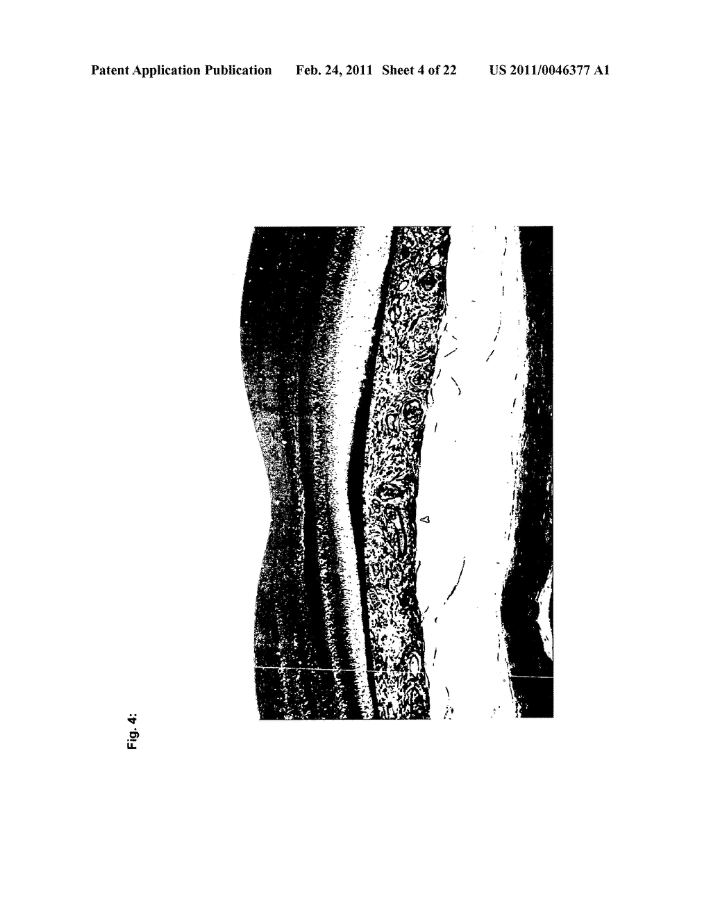 TETRAHYDROPYRIDOETHERS FOR TREATMENT OF AMD - diagram, schematic, and image 05