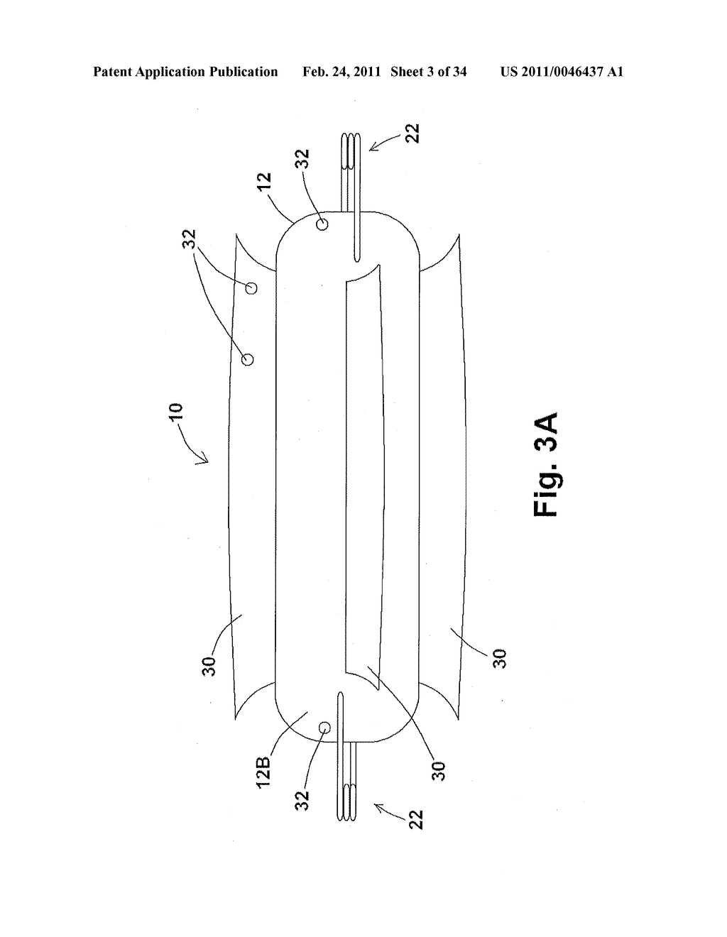 TISSUE RESTORATION DEVICES, SYSTEMS, AND METHODS - diagram, schematic, and image 04