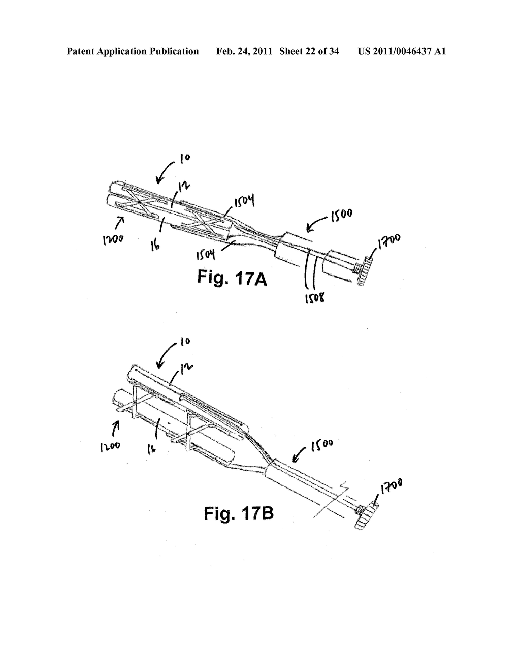 TISSUE RESTORATION DEVICES, SYSTEMS, AND METHODS - diagram, schematic, and image 23