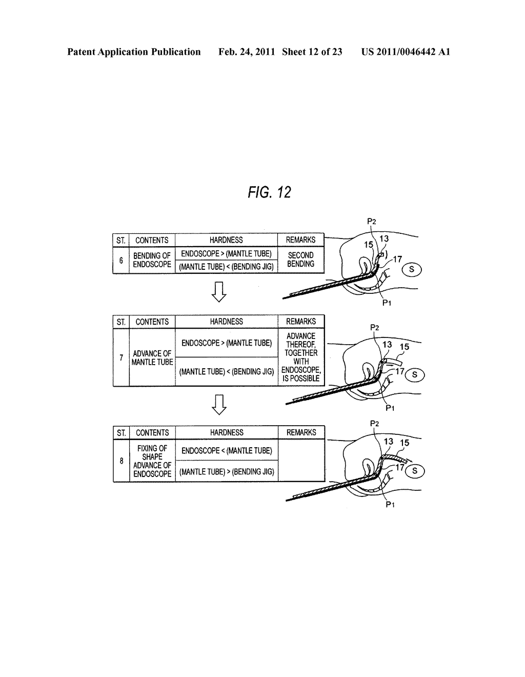 INSERTION PATH SECURING APPARATUS AND MANTLE TUBE - diagram, schematic, and image 13