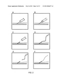 Vascular access methods and devices diagram and image