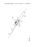 Vascular access methods and devices diagram and image