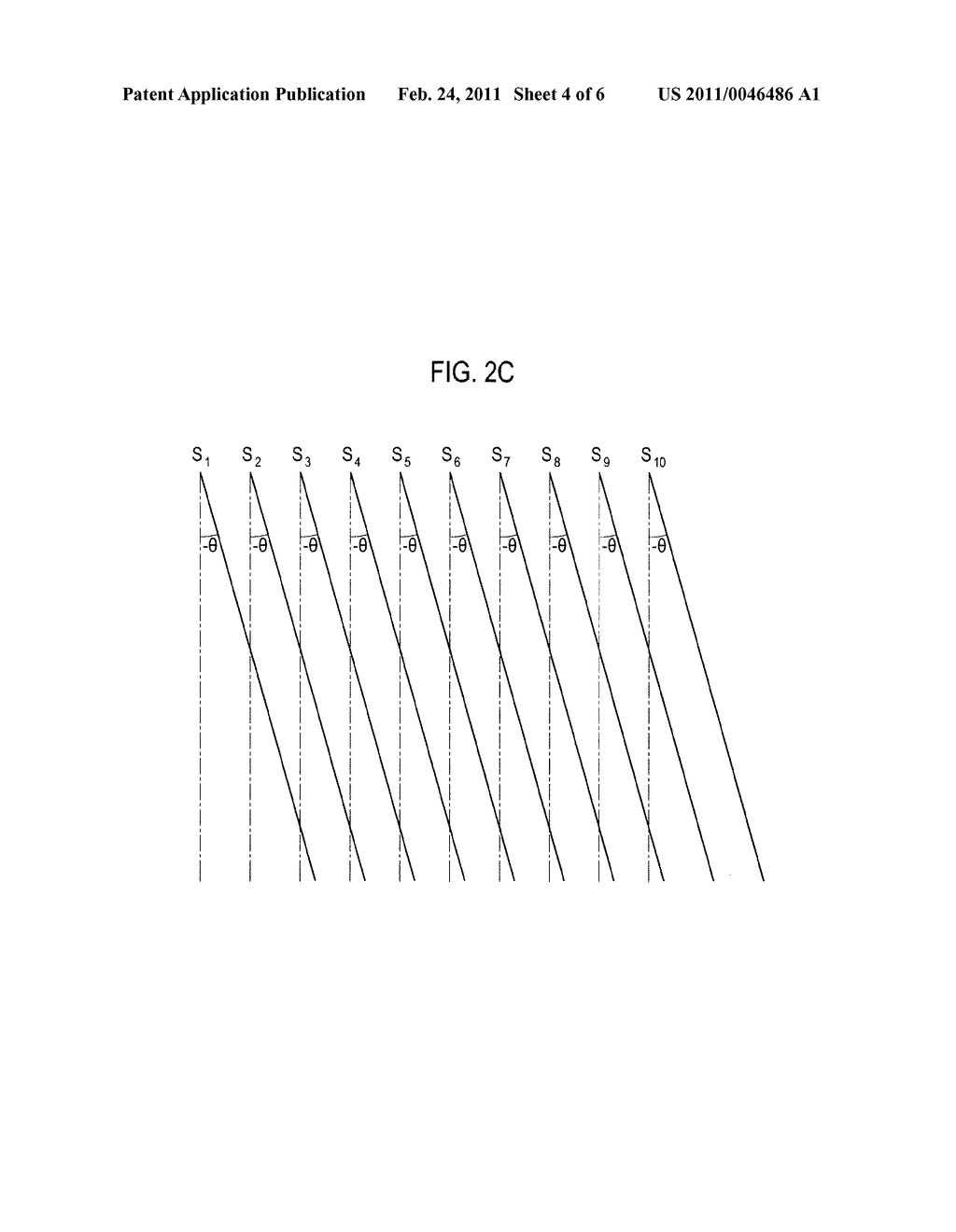 ULTRASOUND IMAGE ENHANCEMENT IN AN ULTRASOUND SYSTEM - diagram, schematic, and image 05