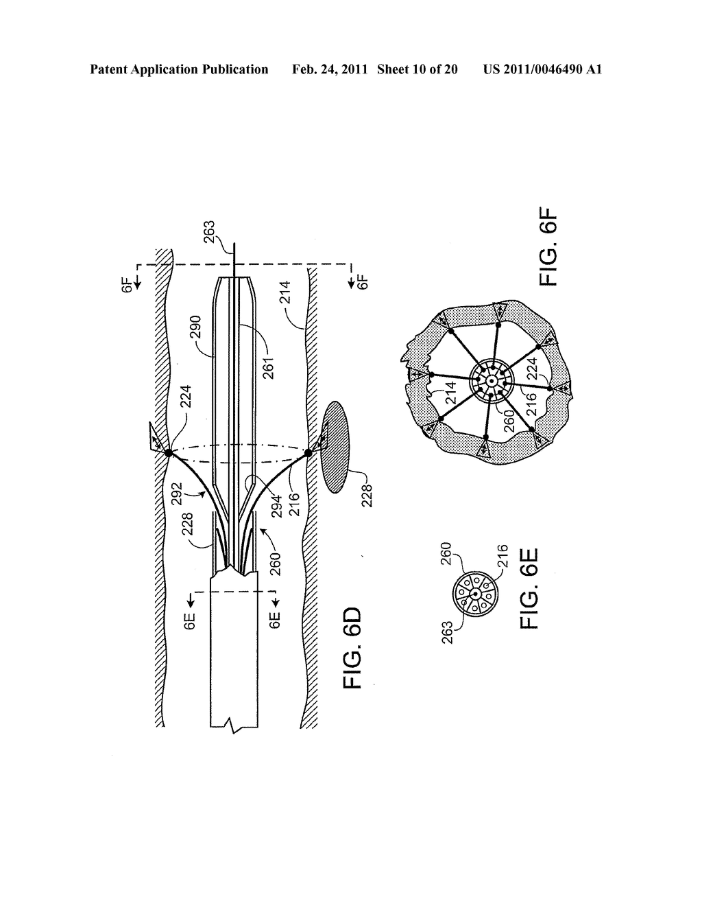 ARTERIAL PROBE FOR OCT - diagram, schematic, and image 11