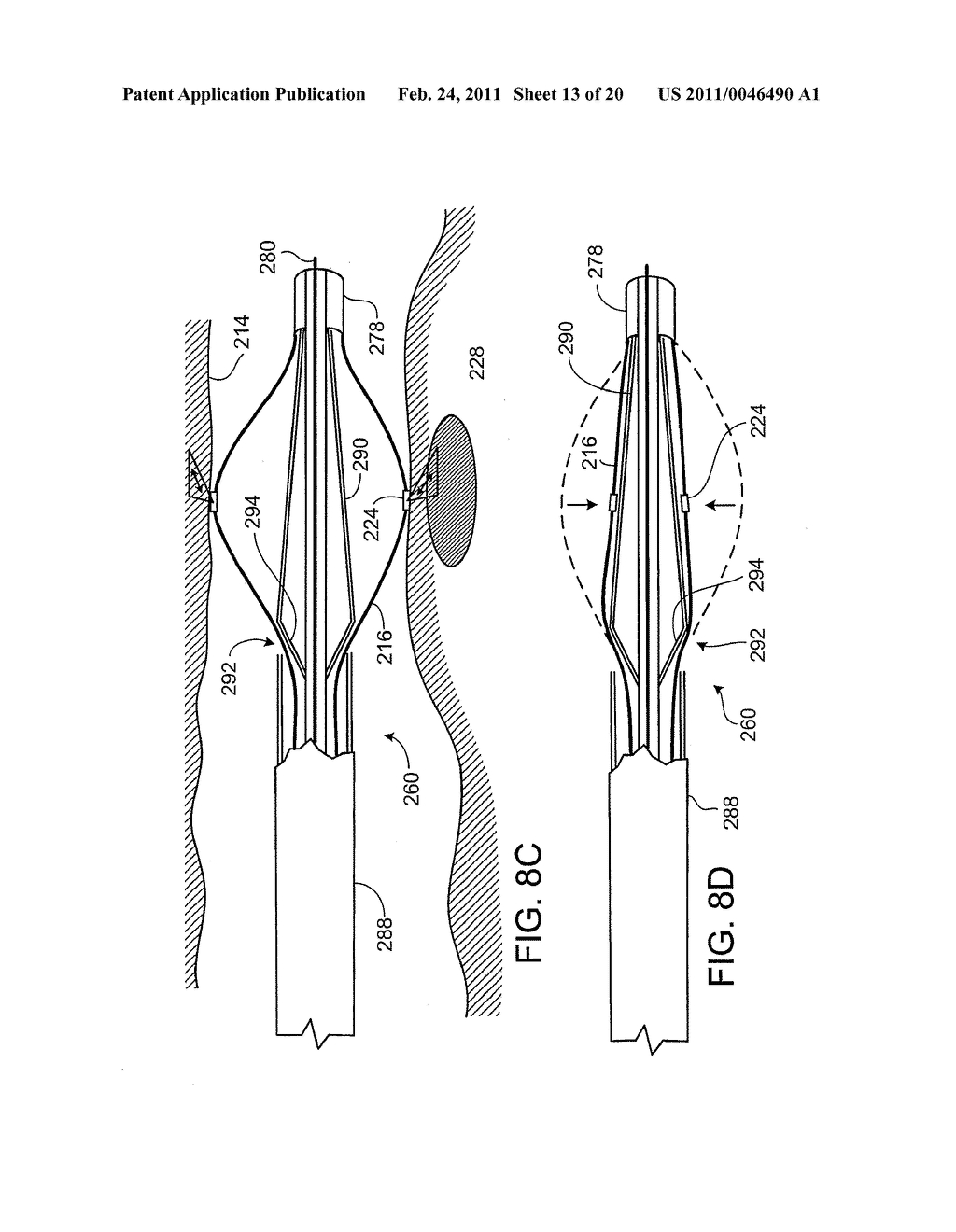 ARTERIAL PROBE FOR OCT - diagram, schematic, and image 14