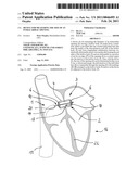 DEVICE FOR MEASURING THE SIZE OF AN INTRACARDIAC OPENING diagram and image