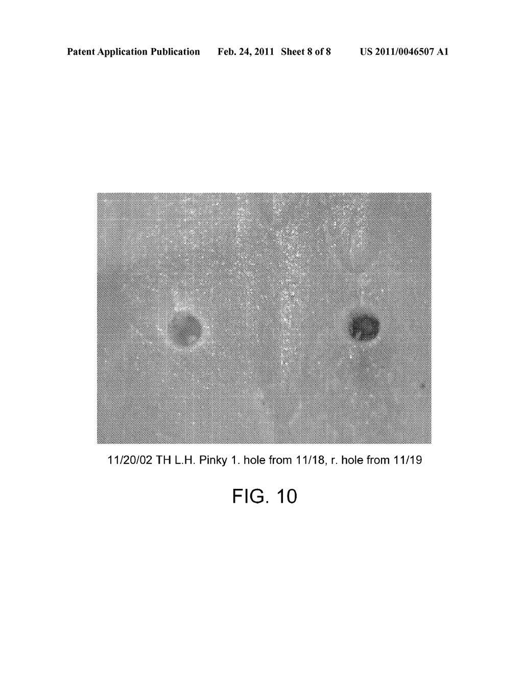 DRILL DEVICE AND METHOD FOR FORMING MICROCONDUITS - diagram, schematic, and image 09