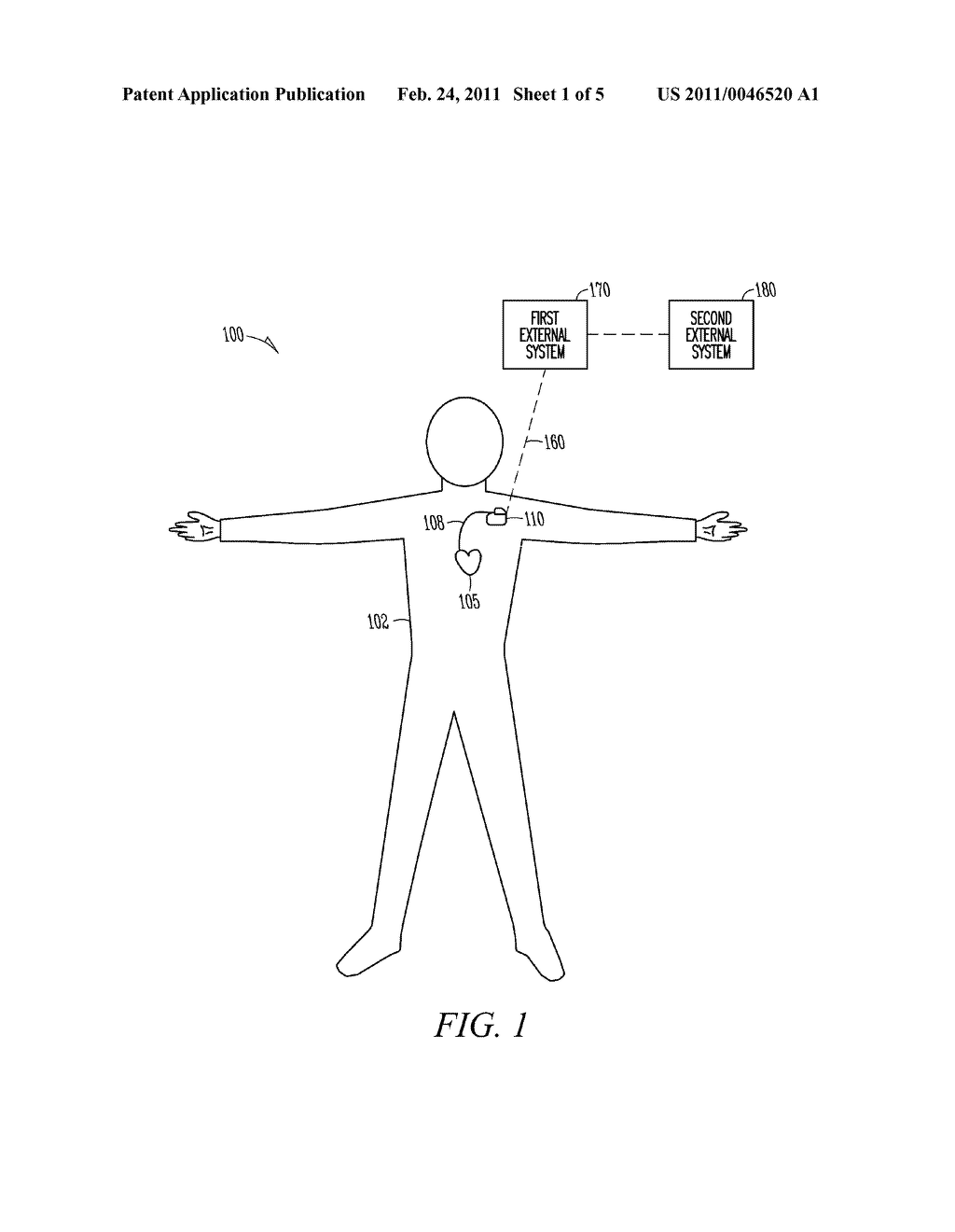 IMPLANTABLE MEDICAL DEVICE CONFIGURED AS A PEDOMETER - diagram, schematic, and image 02