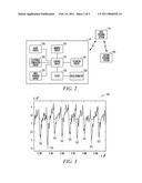 IMPLANTABLE MEDICAL DEVICE CONFIGURED AS A PEDOMETER diagram and image