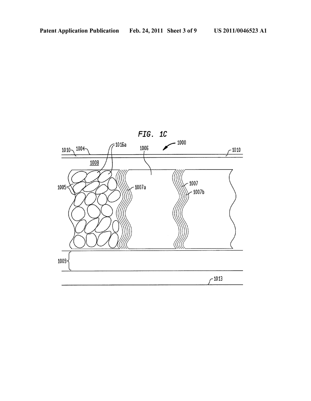 METHOD FOR IMPROVEMENT OF CELLULITE APPEARANCE - diagram, schematic, and image 04