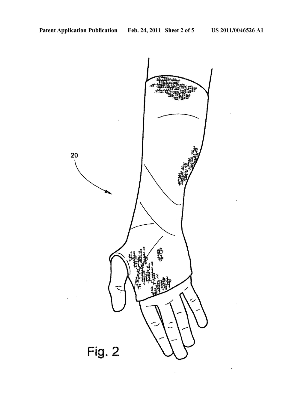 WATER RESISTANT BANDAGE - diagram, schematic, and image 03