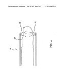 APPARATUS AND A METHOD FOR MONITORING A VASCULAR ACCESS diagram and image