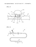 INTERNAL MEDICAL DEVICES FOR DELIVERY OF THERAPEUTIC AGENT IN CONJUNCTION WITH A SOURCE OF ELECTRICAL POWER diagram and image