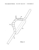 APPARATUS AND METHODS FOR CLOT DISSOLUTION diagram and image