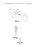 METHOD AND DEVICE FOR VEIN ABLATION diagram and image