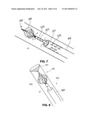 METHOD AND DEVICE FOR VEIN ABLATION diagram and image