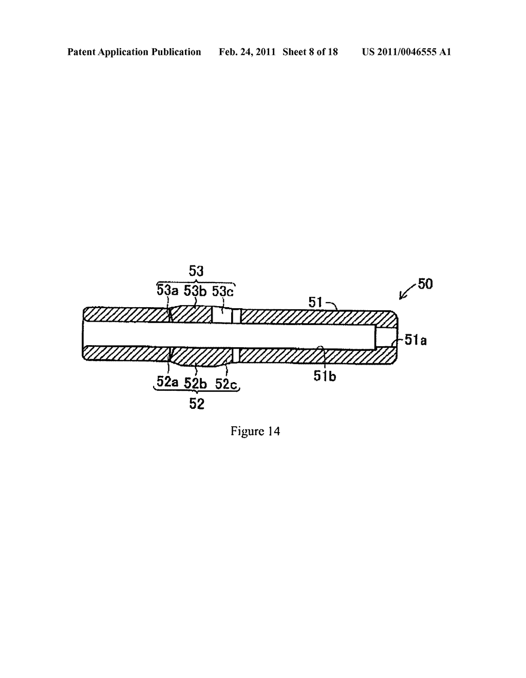 INTERNAL NEEDLE - diagram, schematic, and image 09