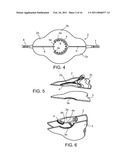 LIQUID STREAMING DEVICES AND METHOD OF USING SUCH DEVICES FOR TREATING WOUNDS diagram and image