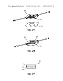 LIQUID STREAMING DEVICES AND METHOD OF USING SUCH DEVICES FOR TREATING WOUNDS diagram and image