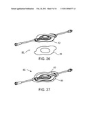 LIQUID STREAMING DEVICES AND METHOD OF USING SUCH DEVICES FOR TREATING WOUNDS diagram and image