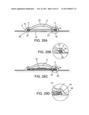 LIQUID STREAMING DEVICES AND METHOD OF USING SUCH DEVICES FOR TREATING WOUNDS diagram and image