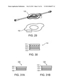 LIQUID STREAMING DEVICES AND METHOD OF USING SUCH DEVICES FOR TREATING WOUNDS diagram and image