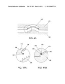 LIQUID STREAMING DEVICES AND METHOD OF USING SUCH DEVICES FOR TREATING WOUNDS diagram and image