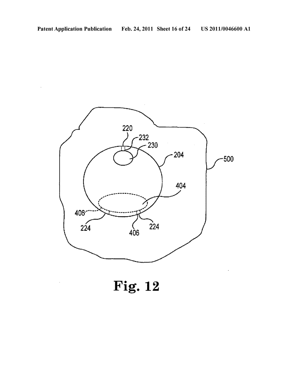 DEVICES, SYSTEMS, AND RELATED METHODS FOR DELIVERY OF FLUID TO TISSUE - diagram, schematic, and image 17