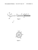 IMPLANT RELEASE MECHANISM diagram and image