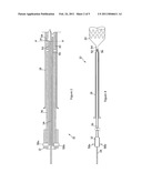 IMPLANT RELEASE MECHANISM diagram and image