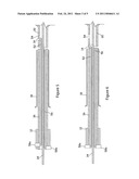 IMPLANT RELEASE MECHANISM diagram and image