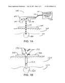 APPARATUS AND METHOD FOR FAT REMOVAL diagram and image