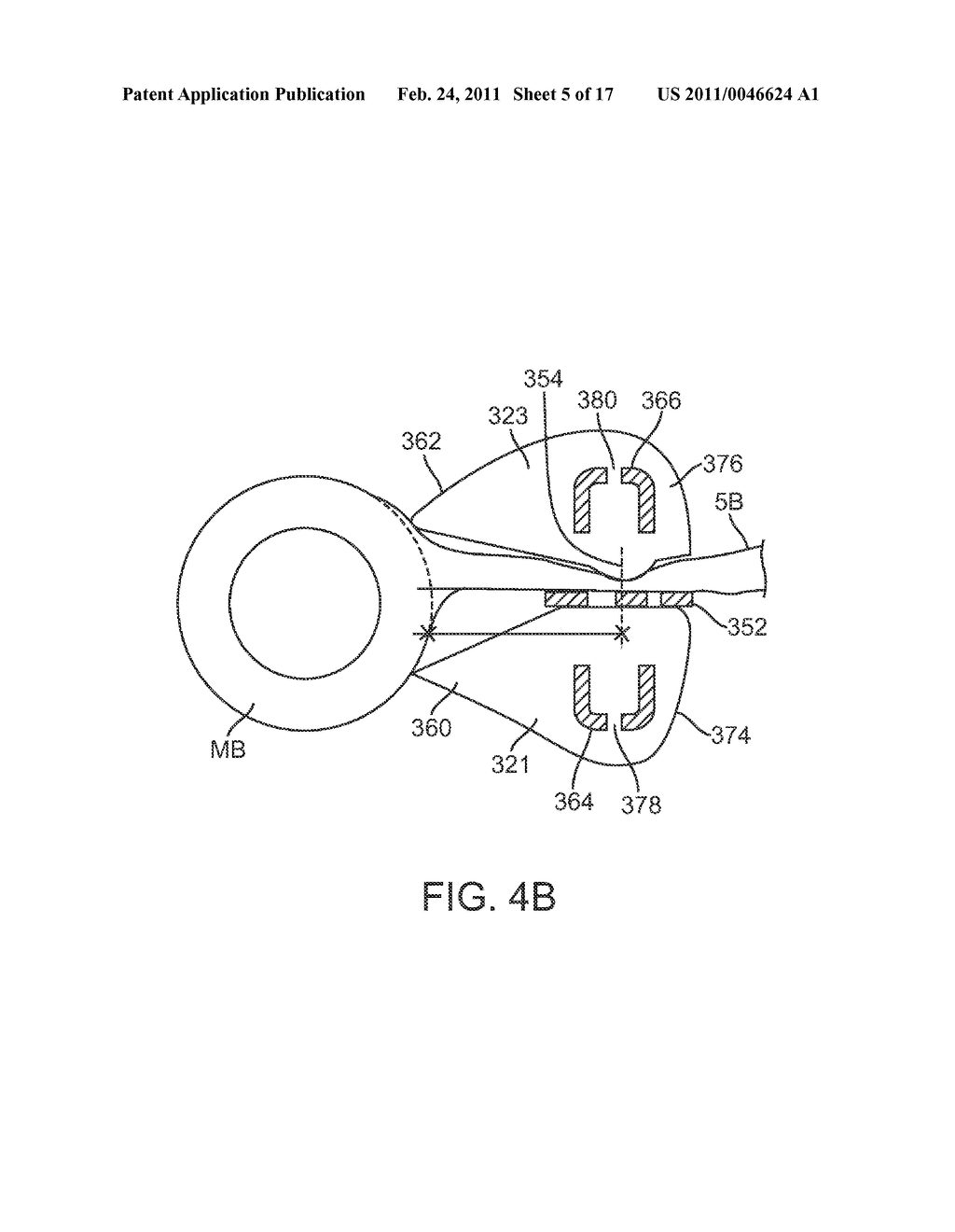 SINGLE HANDLED ENDOSCOPIC VESSEL HARVESTING SYSTEM WITH ROTATION CONTROL - diagram, schematic, and image 06