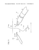 SUTURING AND LIGATING METHOD diagram and image