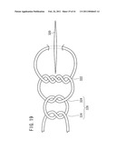 SUTURING AND LIGATING METHOD diagram and image