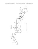 SUTURING AND LIGATING METHOD diagram and image