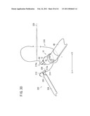 SUTURING AND LIGATING METHOD diagram and image