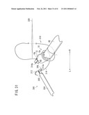 SUTURING AND LIGATING METHOD diagram and image