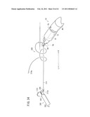 SUTURING AND LIGATING METHOD diagram and image