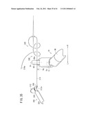 SUTURING AND LIGATING METHOD diagram and image