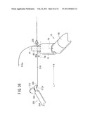 SUTURING AND LIGATING METHOD diagram and image