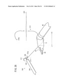 SUTURING AND LIGATING METHOD diagram and image