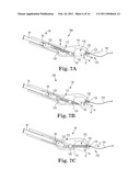 TISSUE SUTURING METHOD diagram and image