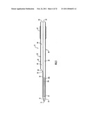 Instruments and Methods for Minimally Invasive Carpal Tunnel Release diagram and image