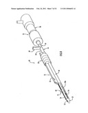 Instruments and Methods for Minimally Invasive Carpal Tunnel Release diagram and image