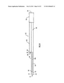 Instruments and Methods for Minimally Invasive Carpal Tunnel Release diagram and image