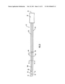 Instruments and Methods for Minimally Invasive Carpal Tunnel Release diagram and image